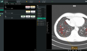 Coreline Comfortable scores imaging AI provide contracts with UK NHS, Boehringer Ingelheim and extra briefs